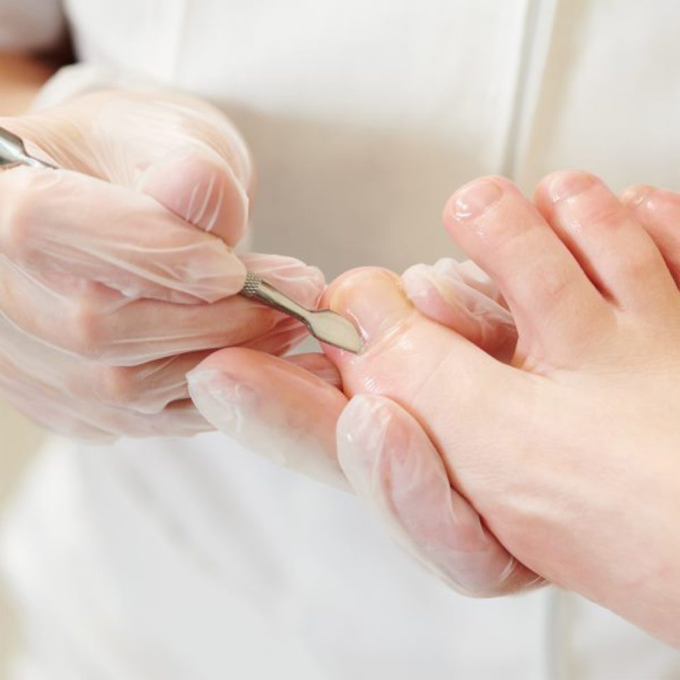 pedicure sito